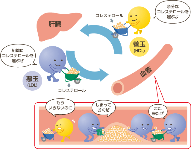 sdLDLとは｜sdLDLどっとこむ for medical professionals