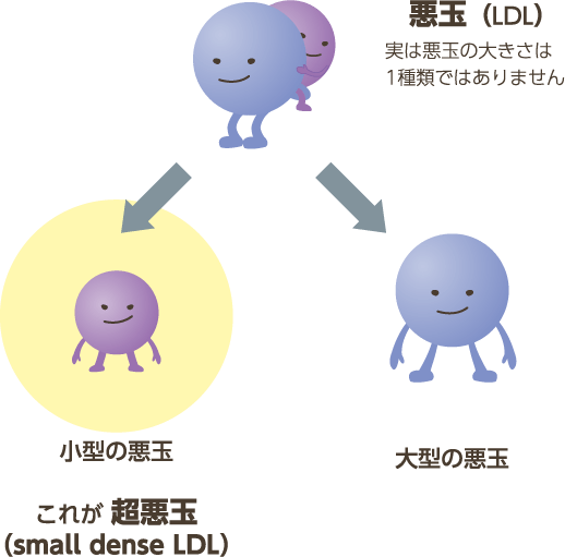 イラスト：悪玉LDLと超悪玉（small dense LDL）