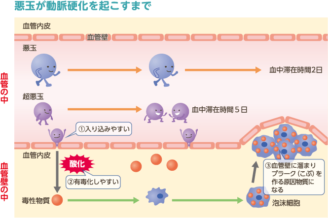 イラスト：悪玉が動脈硬化を起こすまで
